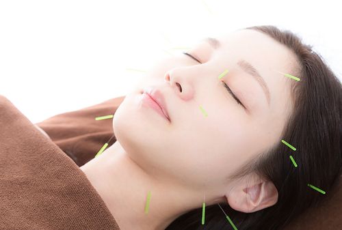 针灸治疗失眠.jpg
