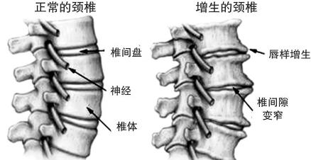 中医带你走进颈椎病.jpg