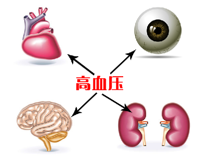原发性高血压的症状