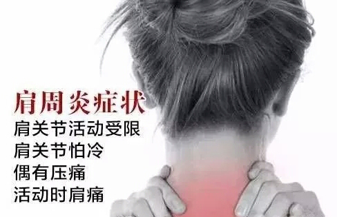 得了肩周炎怎么治疗