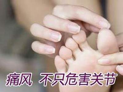 如何确定自己患了痛风