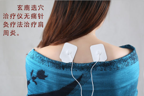 治疗肩周炎