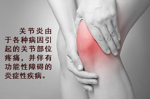 关节炎的并发症你可知晓？