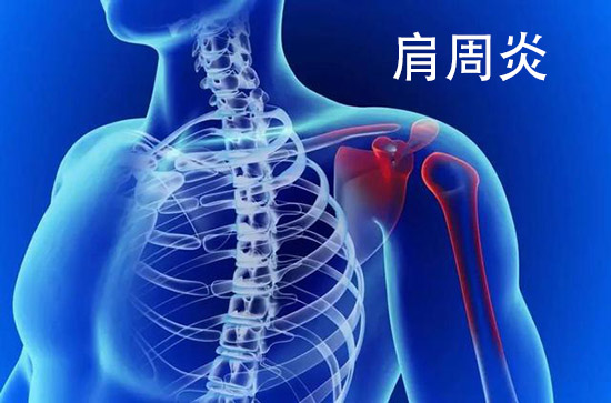 肩痛难忍，要小心肩周炎-玄鹿选穴治疗仪