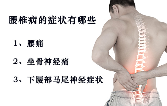 腰椎病的症状有哪些