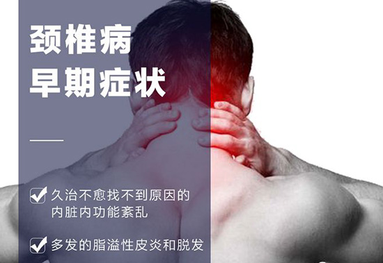 颈椎病怎么治疗