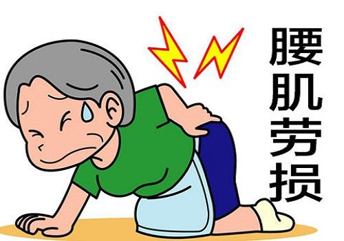 腰肌劳损都有哪些早期症状